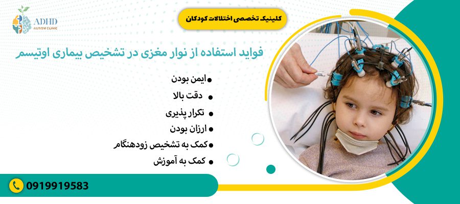 فواید استفاده از نوار مغزی در تشخیص بیماری اوتیسم